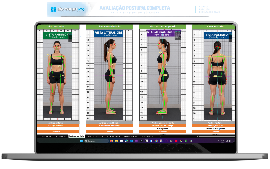 Avaliação Postural Completa com as 4 Vistas no BioPostura Pro
